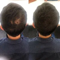 موهات از چمن بیشتر میشه