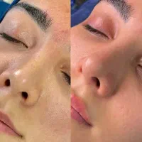 پاکسازی تخصصی ۳۸۰