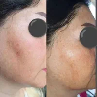 دفترنمایندگی رسمی کرم ضدلک لاکچری کوین(اصلی)