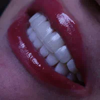 استخدام مشاور تلفنی در کلینیک دندانپزشکی