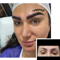 جشنواره تخفیف کاشت تخصصی ابرو