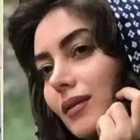 تخفیف ۱۰ میلیونی عمل جراحی بینی