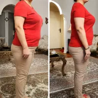 تنها و بهترین روش لاغری ونتیجه قطعی باکرایولیپولیز