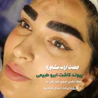 کاشت مو و ابرو وبلفارو  قعب قعب  و بوتاکس