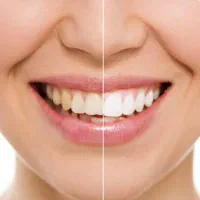 دندانپزشکی دکتر نیلوفر یزدیان