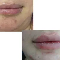 زیبایی|خدمات آرایشگری و زیبایی|ماهدشت, |دیوار