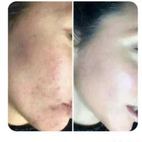 کرم معجزه اصل بدون ذره ای ناخالصی بدون کورتون