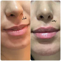 آموزش پزشکی زیبایی