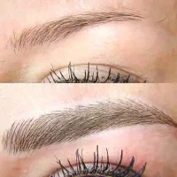 نیازمند دونفر مدل رایگان میکرو و فیبروز کرکی مویی