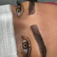 میکرو(فیبروز) شیدلب،بن مژه،خطچشم