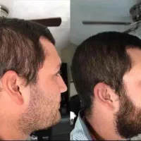 زودتر اقدام کن هیچوقت دیر نیست