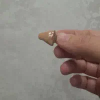 تجویز و تست سمعک توسط ادیولوژیست