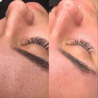 (پاکسازی و مراقبت پوست)