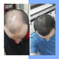 فرمولاسیون قوی
