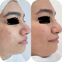 فیشال تخصصی وخدمات پوستی