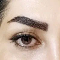 کاشت ابرو وترمیم ابرو