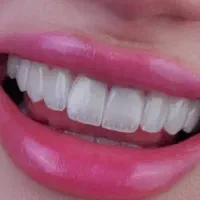 همکاری دندان پزشک با پروانه.