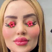 آف تزریق تخصصی ژل بوتاکس.کاشت مژه.تتو صورت و بدن