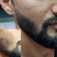 احیا کننده‌ی ریش،مو،ابرو و مژه