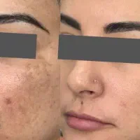 پک کرم و صابون ضدلک و روشن کننده صورت اصل|آرایشی، بهداشتی، درمانی|تهران, شهرک غرب|دیوار