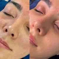 خدمات فشیال و پاکسازی