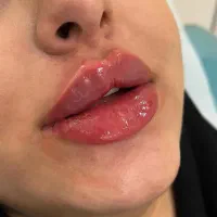 فیلر فقط برا امروز ۱۵۰۰