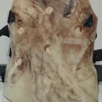 کمربند طبی جراحی دیسک کمر