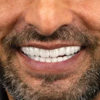 تخفیف تخصصی ترین مرکز جراحی ایمپلنت دندان پزشکی