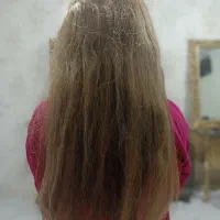 انواع تراپی ها