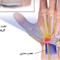 راهنمایی میخام