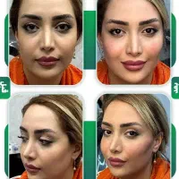 بزرگ کردن باسن و سینه