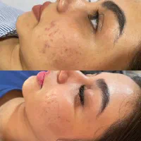 مرکز تخصصی فیشال لاغری . درمانی