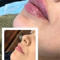 جشنواره تحفیفات کلینیک زیبایی