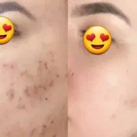 پوستینو|آرایشی، بهداشتی، درمانی|مشهد, حسین‌آباد|دیوار