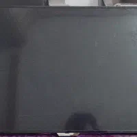 ایکس ویژن