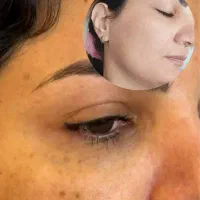 فشیال تخصصی ودرمانی وحذف کک ومک تنهادریک جلسه