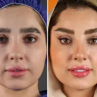 جراحی زیبایی/نقاهت شما در تعطیلات/تخفیف دوروزه
