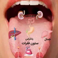 بانوی عزیز در منزل به در آمد برس