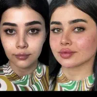 ژل ۱۵۰۰ هر سی سی قیمت پارسال
