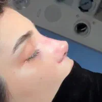 عمل جراحی زیبایی بینی،پلک،لیفت صورت،اندام