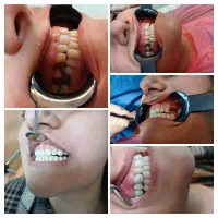 خدمات دندانپزشکی با شرایط ویژه