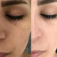 بااین ص.ا.بون پوستتو سفیدکن