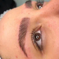میکروبلیدینگ ابرو، فیبروز ابرو