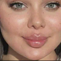 جشنواره کلینیک زیبایی ژل فیلر بوتاکس لیزر لاغری