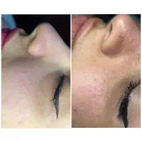 پاکسازی تخصصی ویژه فقط 400ت
