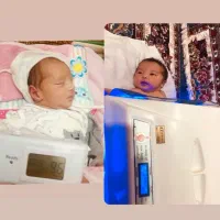 دستگاه زردی به همراه تخت نوزاد و تشک مخصوص اجاره
