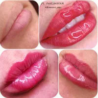 اجرای تخصصی شیدینگ لب و رفع تیرگی