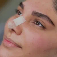 فیبروز و میکروبلیدینگ و شدینگ