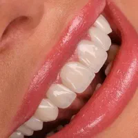 کامپوزیت دندان در اصفهان با پرداخت اقساطی|خدمات زیبایی و سلامت|اصفهان, میرعماد|دیوار