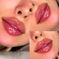 فیلربوتاکس و پی ارپی